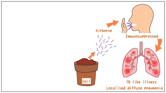 Nocardia  Microbiology: Morphology, Pathophysiology, Symptoms, Diagnosis, Treatment
