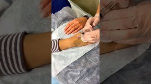 БИОРЕВИТАЛИЗАЦИЯ КИСТЕЙ РУК