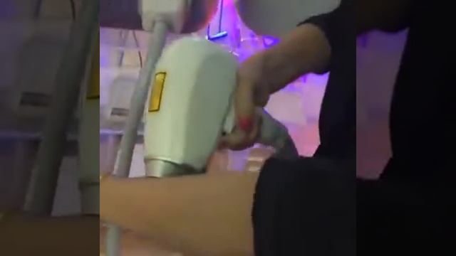 Диодный лазер HONKON YILIYA-808 Cute смотреть онлайн