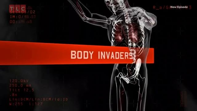 Инородные тела 1 сезон 2 серия смотреть онлайн