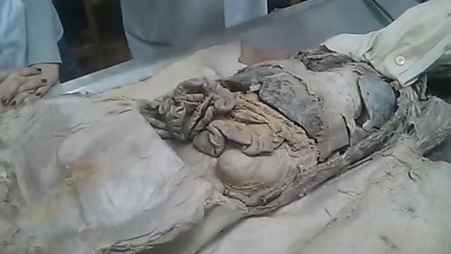 Брюшина. Peritoneum. анатомия часть 1 смотреть онлайн