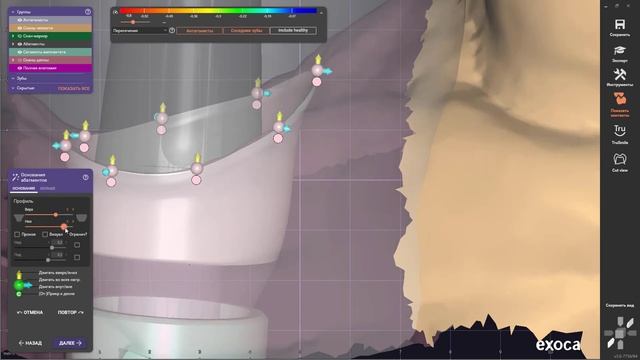 Тестирую EXOCAD GALWAY 3.0 коронка с винтовой фиксацией смотреть онлайн