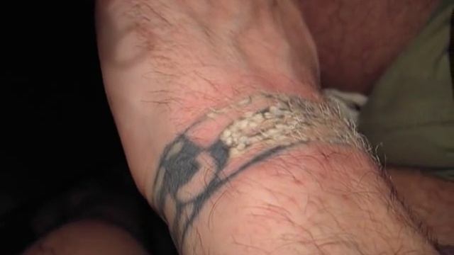 Удаление татуировки на запястье смотреть онлайн
