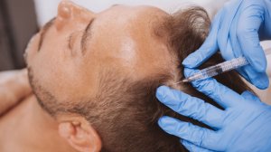 Плазмотерапия для волос.