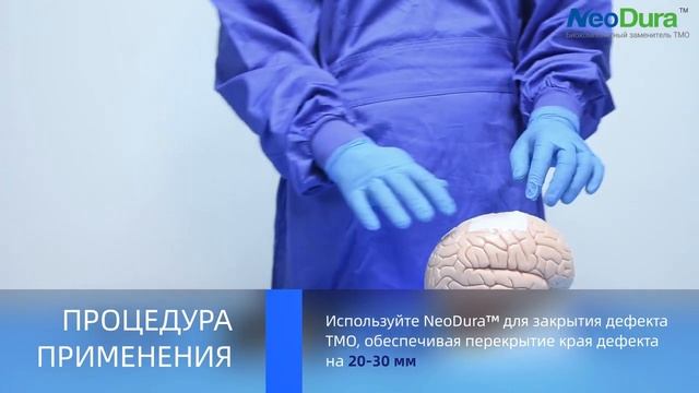 Биомиметическая матрица для восстановления ТМО NeoDura™ смотреть онлайн