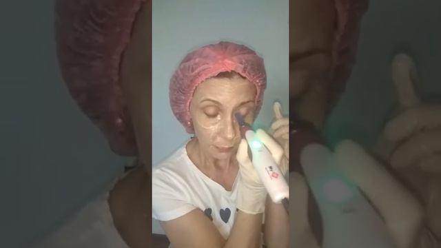 Выравниваем цвет лица в домашних условиях смотреть онлайн