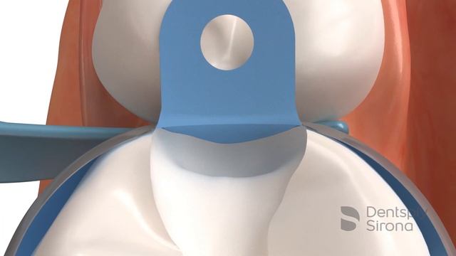 Матричная система PalodentV3_как пользоваться смотреть онлайн