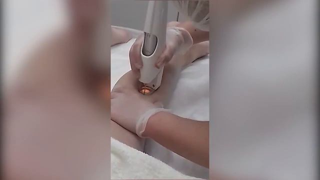 Лазерная эпиляция. Пожизненный эффект смотреть онлайн