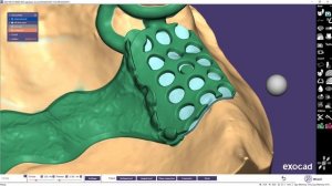 EXOCAD PartialCad  Один из многих бюгельных протезов