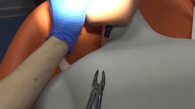 Удаление зуба/Пломбирование полости зуба смотреть онлайн