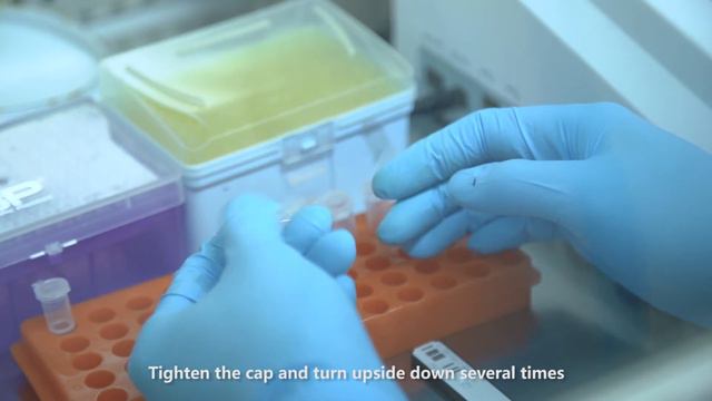 SOP of Finecare™ 2019-nCoV IgM/IgG Test (Fluorescence Immunoassay) смотреть онлайн