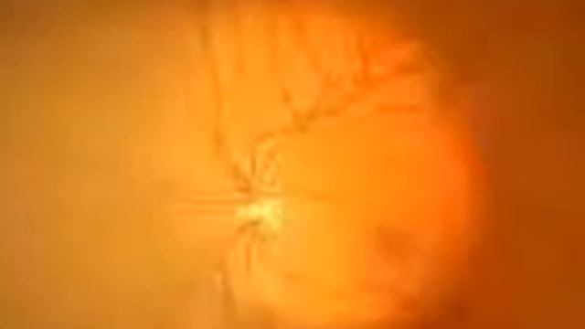 Сетчатка (сетчатая оболочка) глаза - строение и функции смотреть онлайн