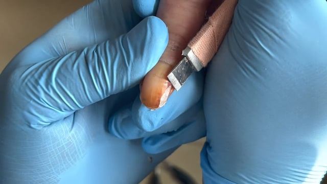 Long nails that haven't been trimmed for a long time, with a lot of dirt【Pedicure Master Lin Jun】 смотреть онлайн