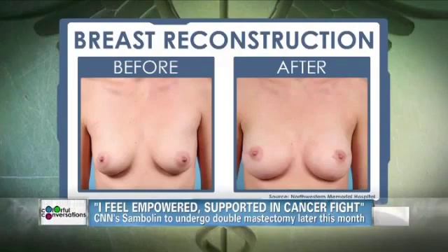Dr. Kim Breast Reconstruction CNN смотреть онлайн
