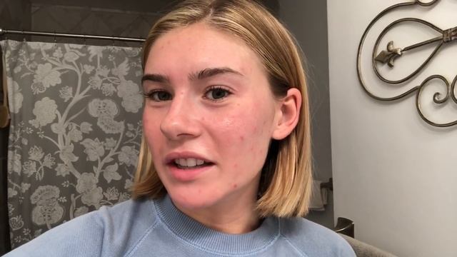 I Got a Chemical Peel!!! The Results: смотреть онлайн