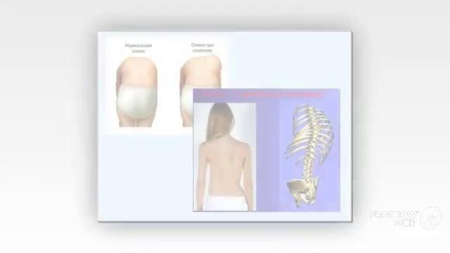 турник для позвоночника смотреть онлайн