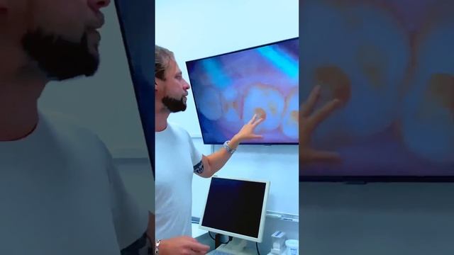 Лечение кариеса  постановка пломбы  наложение коффердама