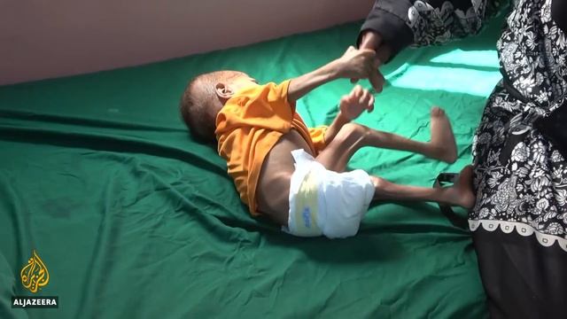 Millions Staring At Famine As Food Insecurity Soars: Report