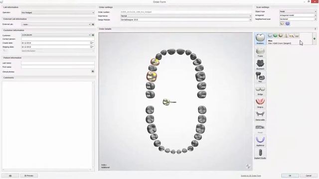 3Shape Dental System - Adding Scan to Existing Case смотреть онлайн
