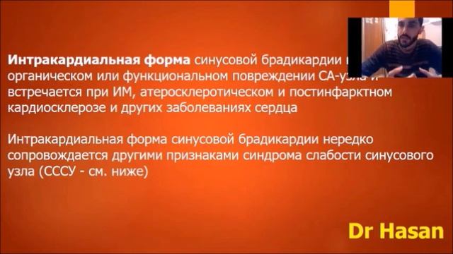 синусовая брадикардия смотреть онлайн
