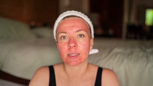 Кровавый пилинг The Ordinary AHA 30% + BHA 2% Peeling Solution | Отшелушивание | Прыщи | Проблемная смотреть онлайн