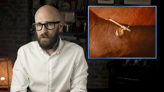 What's Up With the Snake & Staff Symbol for Medicine? смотреть онлайн