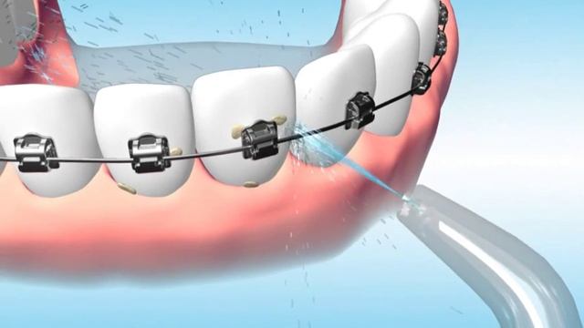 Irrigador Oral com Fio Dental + Escova Dental Sônica Jetpik JP200 Elite смотреть онлайн