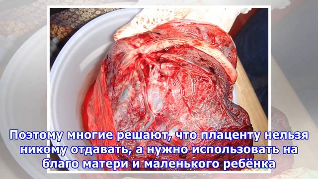 Что за дичь: зачем люди едят плаценту смотреть онлайн