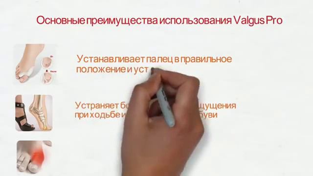 Купить Вальгус Про в Новосибирске смотреть онлайн