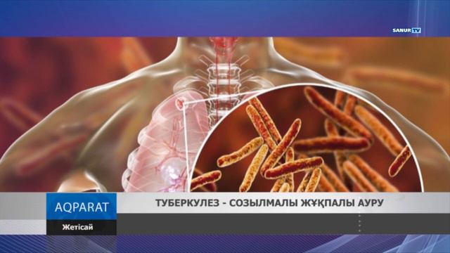 01.07.2019 Жетісай ауданы. Туберкулез созылмалы жұқпалы ауру смотреть онлайн