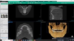 Построение панорамы в программе Ez3D-i