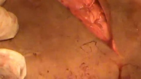 Резекция ребра у телки (p. III). Docent A.D. Stepanov, ПДАТУ