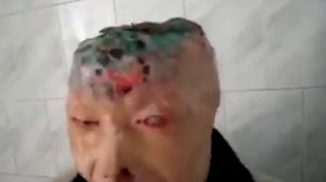 Человек гнил заживо но решил обратиться доктору сейчас