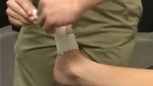 Варианты тейпирование большого пальца ноги