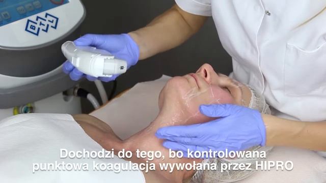 Lifting metodą BTL HIPRO смотреть онлайн