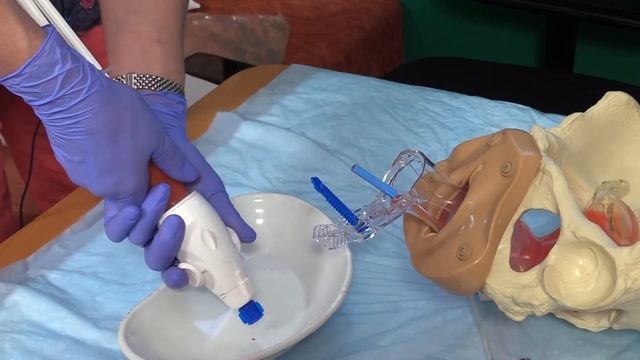 МВА Метод мануальной вакуумной аспирации