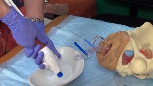 МВА Метод мануальной вакуумной аспирации