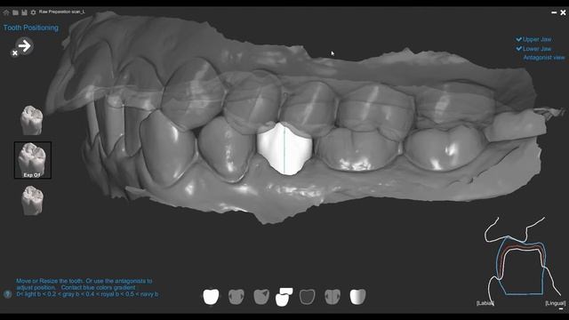 IRIS Chairside CADCAM Tutorial смотреть онлайн