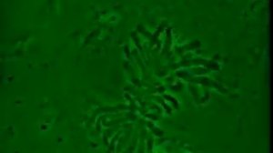 Деление клетки под микроскопом. Митоз. фазы митоза.