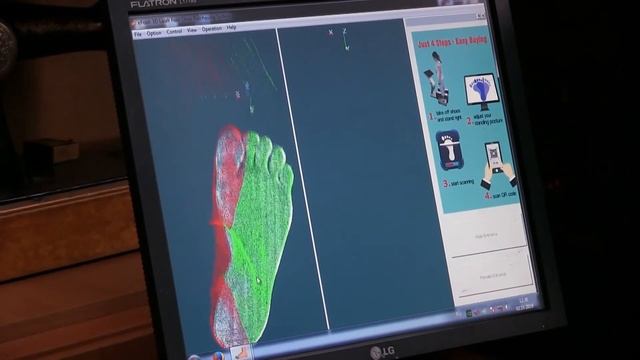 ОРТОПЕДИЧЕСКАЯ ОБУВЬ ДЛЯ БОЛЬНЫХ САХАРНЫМ ДИАБЕТОМ смотреть онлайн