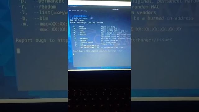 If you are into Ethical Hacking you must know the steps to be anonymous In this video you will get смотреть онлайн