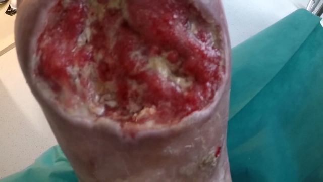 Это УЖАСНОЕ видео. Людям брезгливым и чувствительным не рекомендуется. смотреть онлайн