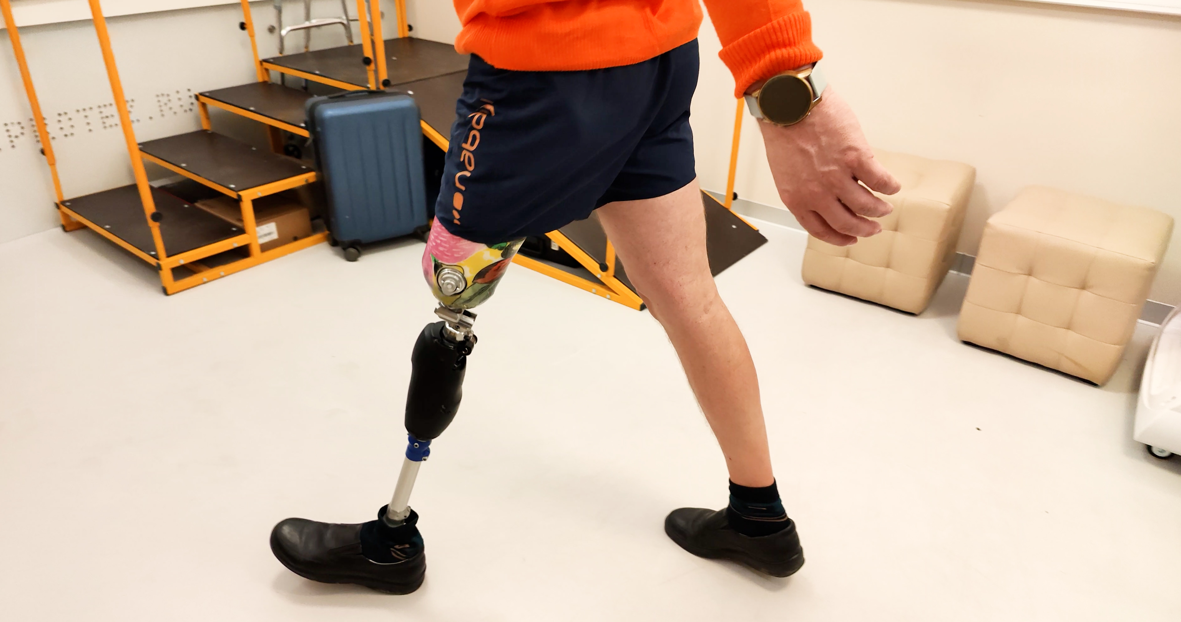 Ходит на протезе ноги с микропроцессором более 10 лет смотреть онлайн