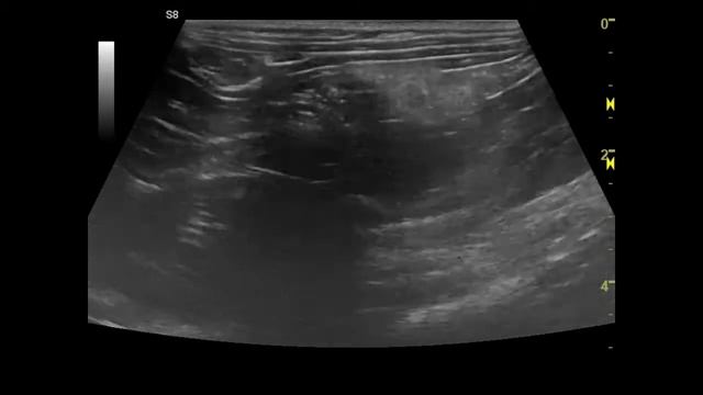 Инородное тело (воздушный шарик) в тощей кишке у кошки на УЗИ смотреть онлайн