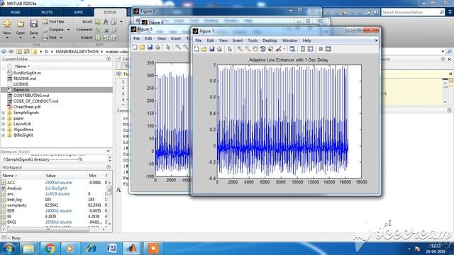 Fetal ECG смотреть онлайн