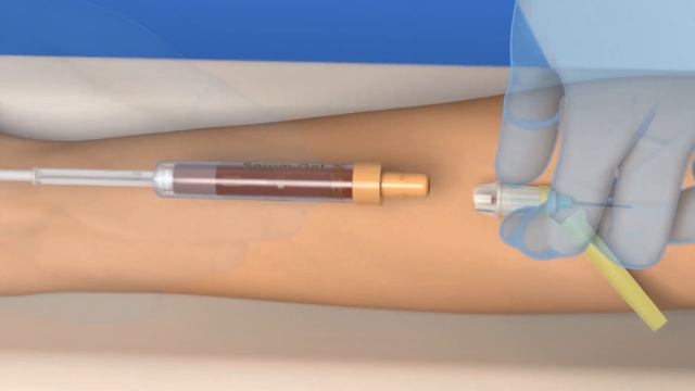 Blood collection: Aspiration with the S-Monovette® (ISO colour code) and Safety-Needle смотреть онлайн