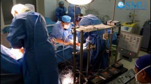 Аорто-коронарное шунтирование