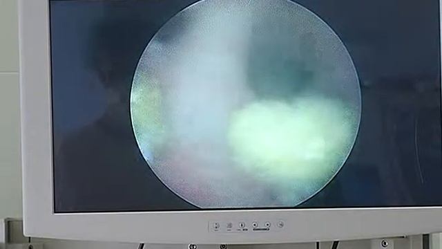 Формула здоровья "Урологический центр БУЗ ВО ВОКБ №1" смотреть онлайн