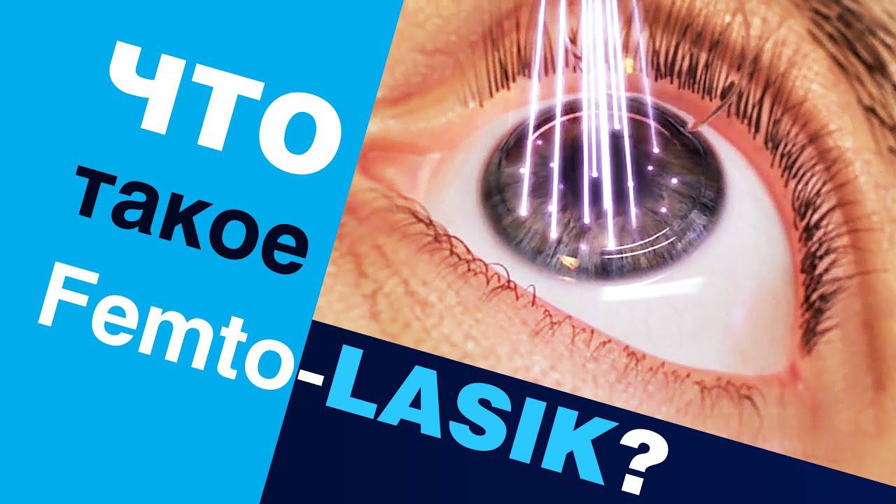 Что такое Femto-LASIK? Лазерная коррекция зрения Femto-LASIK смотреть онлайн