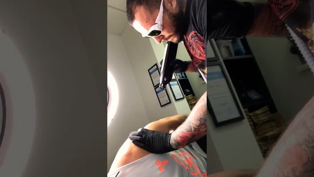 Осветление татуировки лазером смотреть онлайн